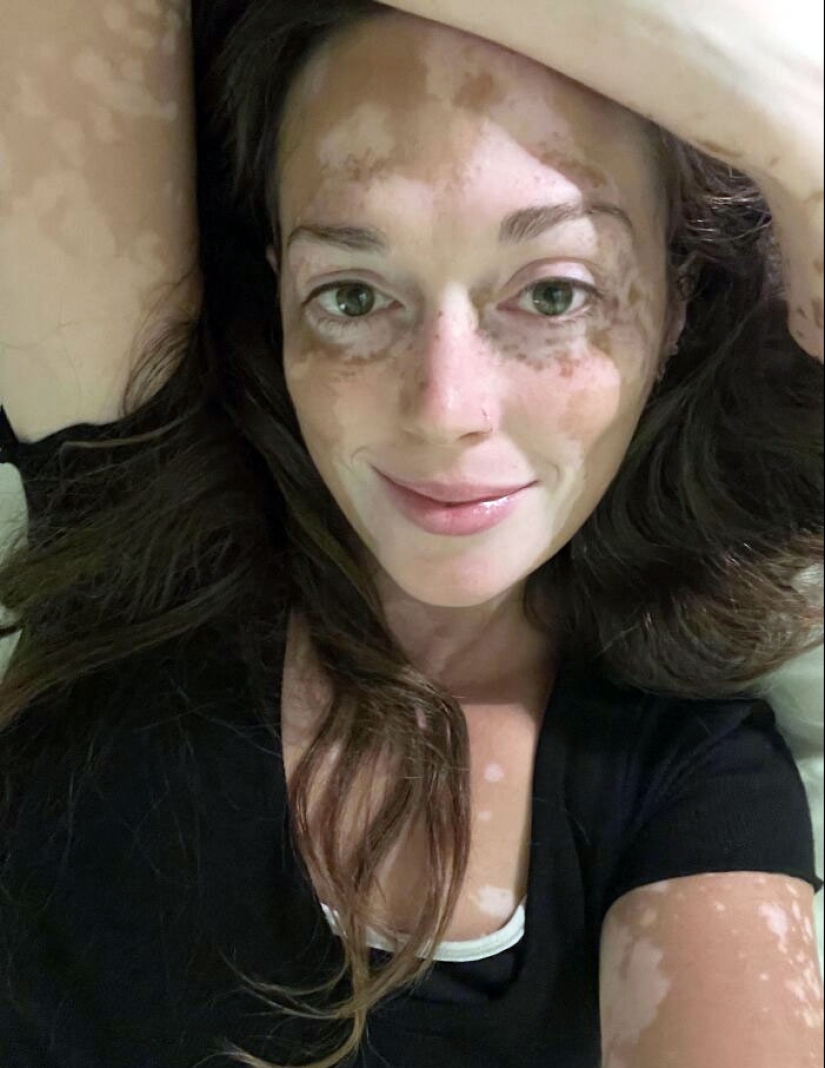 10 fotos de personas que sacaron comodines en la lotería genética