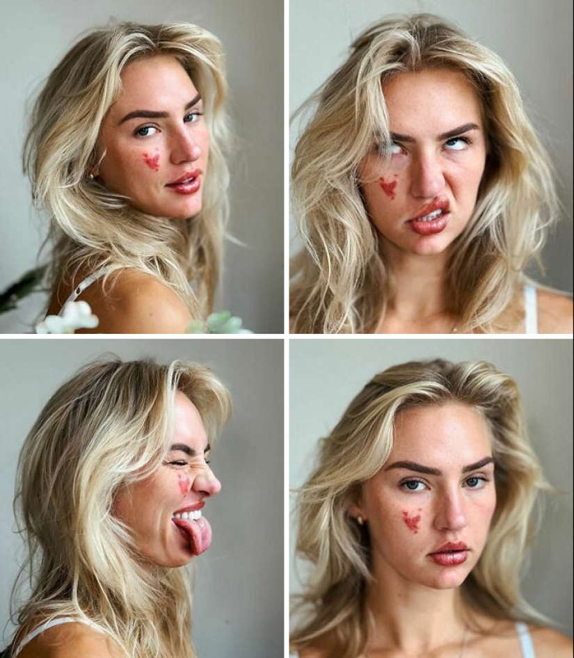 10 Photos Of People Who Drew Wild Cards In The Genetic Lottery