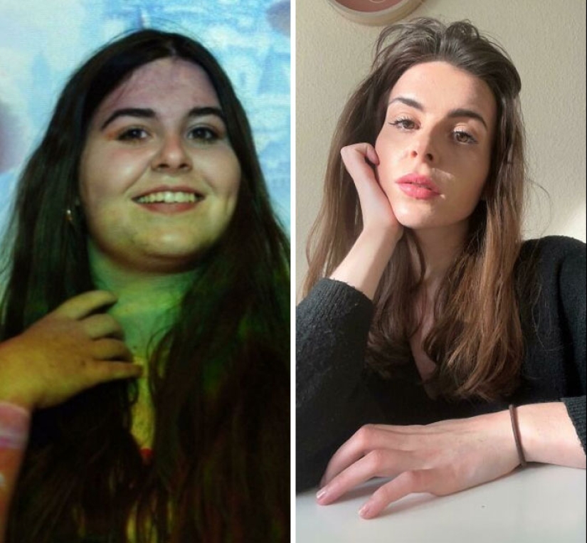 10 Times People Surprised Everyone By Losing So Much Weight They Looked Like A Different Person