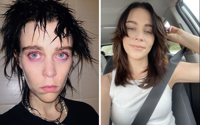 11 Before And After Pictures That Show What Happens When People Overcome Addiction