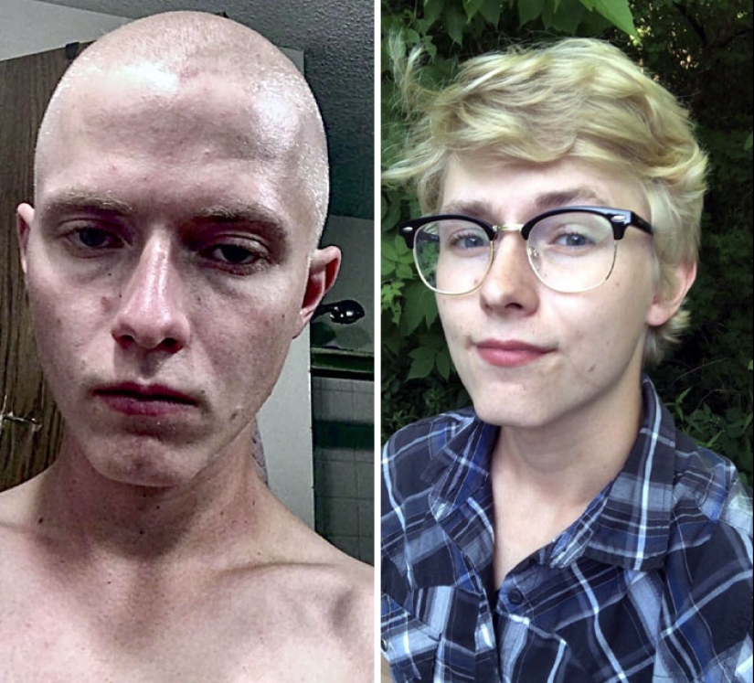 11 Before And After Pictures That Show What Happens When People Overcome Addiction