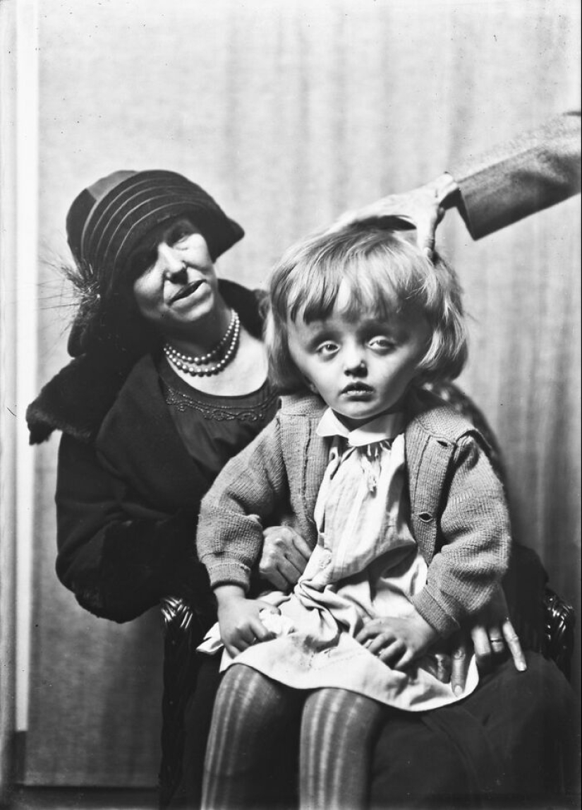 11 Haunting Medical Portraits Of Harvey Cushing’s Patients In The Early 20th Century 11 Haunting Medical Portraits Of Harvey Cushing’s Patients In The Early 20th Century