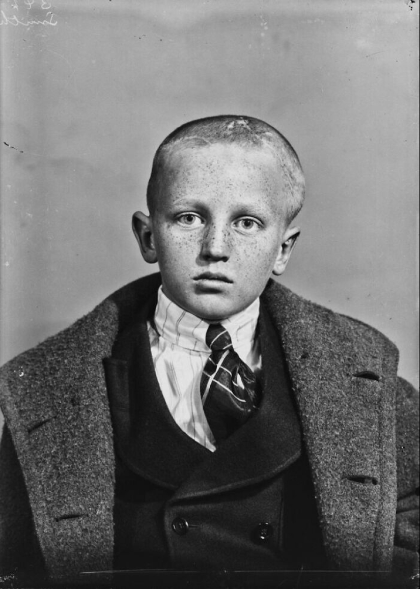 11 Haunting Medical Portraits Of Harvey Cushing’s Patients In The Early 20th Century 11 Haunting Medical Portraits Of Harvey Cushing’s Patients In The Early 20th Century