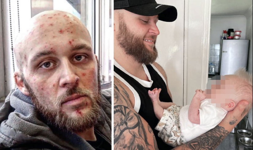 11 imágenes de antes y después que muestran lo que sucede cuando las personas superan la adicción