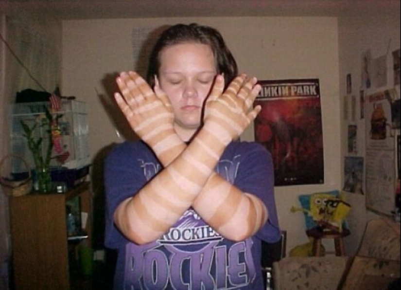 15 People Who Thought They Didn’t Need Sunscreen And Ended Up Looking Like Dorks 15 People Who Thought They Didn’t Need Sunscreen And Ended Up Looking Like Dorks