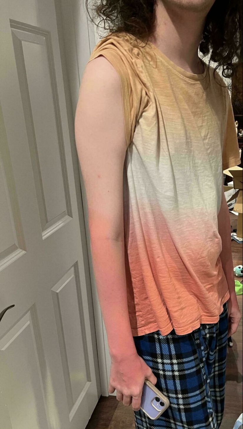 15 People Who Thought They Didn’t Need Sunscreen And Ended Up Looking Like Dorks 15 People Who Thought They Didn’t Need Sunscreen And Ended Up Looking Like Dorks