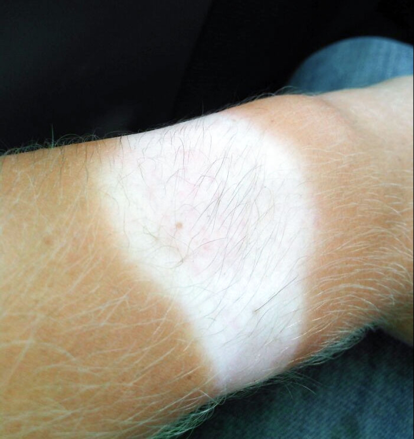 15 People Who Thought They Didn’t Need Sunscreen And Ended Up Looking Like Dorks 15 People Who Thought They Didn’t Need Sunscreen And Ended Up Looking Like Dorks