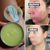 19 Beauty Solutions For Those Winter Issues Nobody Wants To Talk About 19 Beauty Solutions For Those Winter Issues Nobody Wants To Talk About