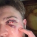 29-Year-Old Trans Man Gets Brutally Beaten Up In Switzerland, Claims It’s A Hate Crime 29-Year-Old Trans Man Gets Brutally Beaten Up In Switzerland, Claims It’s A Hate Crime