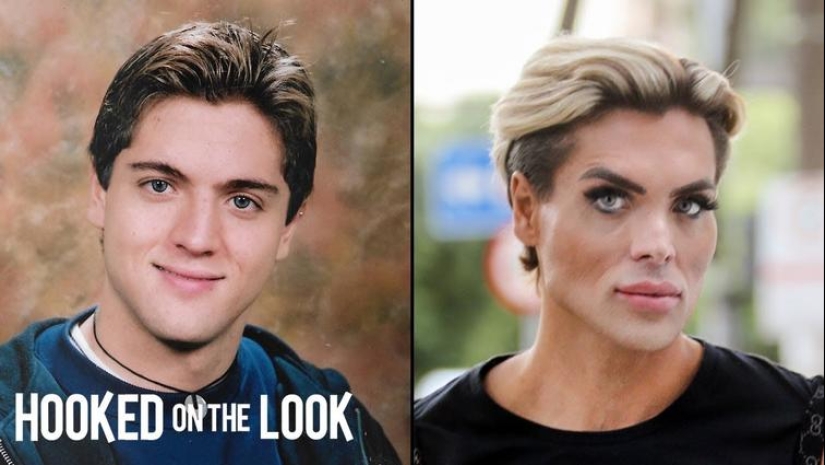 30 people who got carried away with plastic surgery and forgot to stop 30 people who got carried away with plastic surgery and forgot to stop
