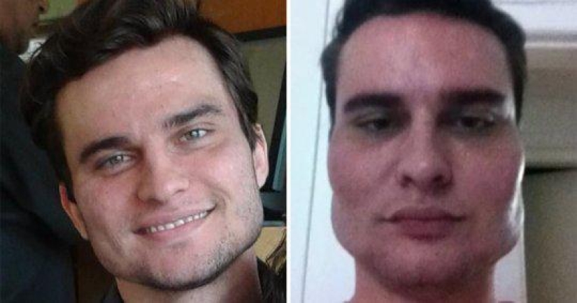 30 people who got carried away with plastic surgery and forgot to stop 30 people who got carried away with plastic surgery and forgot to stop