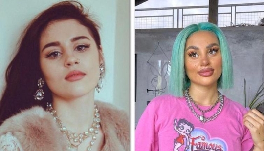 30 people who got carried away with plastic surgery and forgot to stop