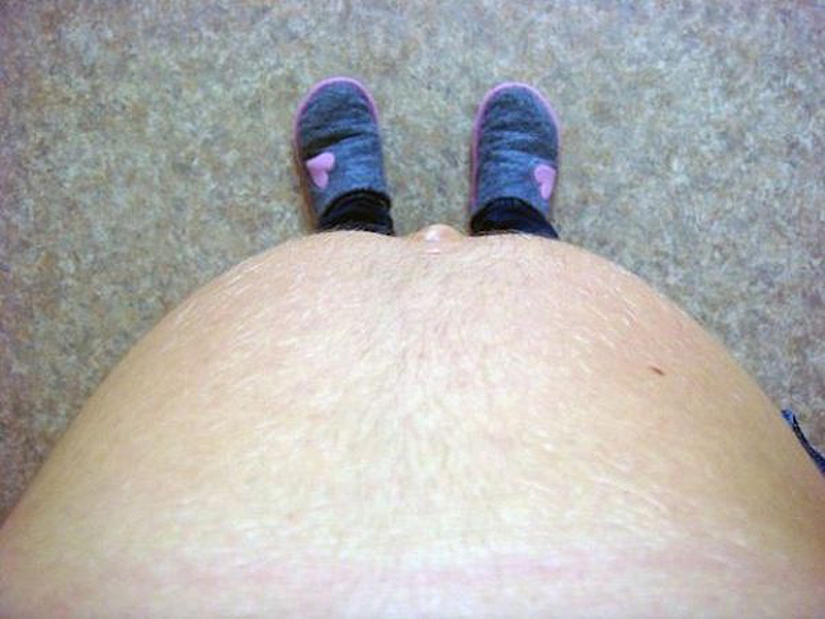 7 facts about belly fat 7 facts about belly fat