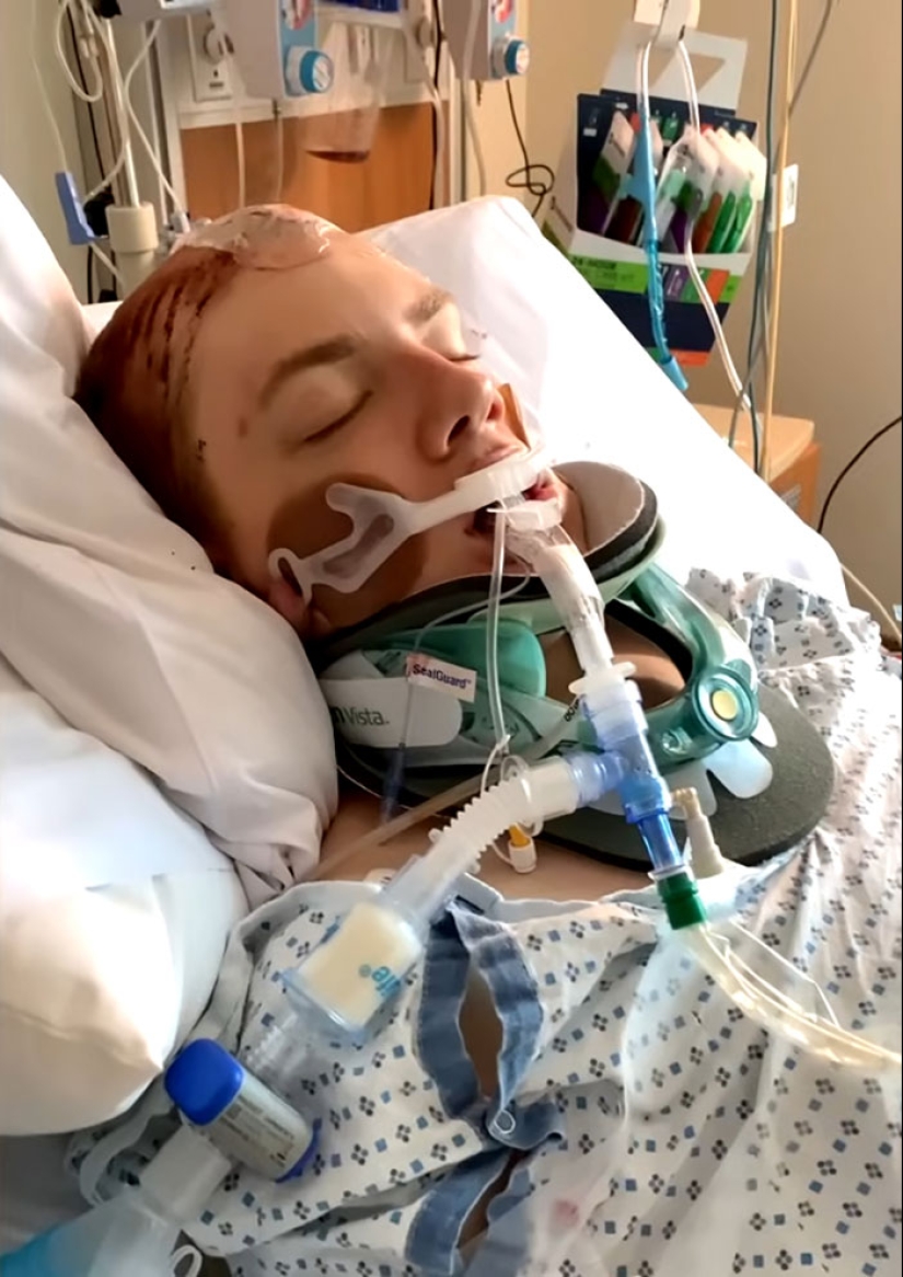 A un hombre que se sometió a cirugías de extirpación del cráneo para “lavar” su cerebro se le niegan beneficios por discapacidad A un hombre que se sometió a cirugías de extirpación del cráneo para “lavar” su cerebro se le niegan beneficios por discapacidad