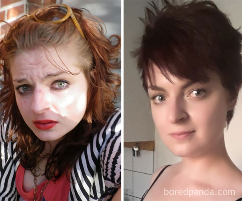 Antes y después: cómo cambia la apariencia de una persona que deja de beber Antes y después: cómo cambia la apariencia de una persona que deja de beber