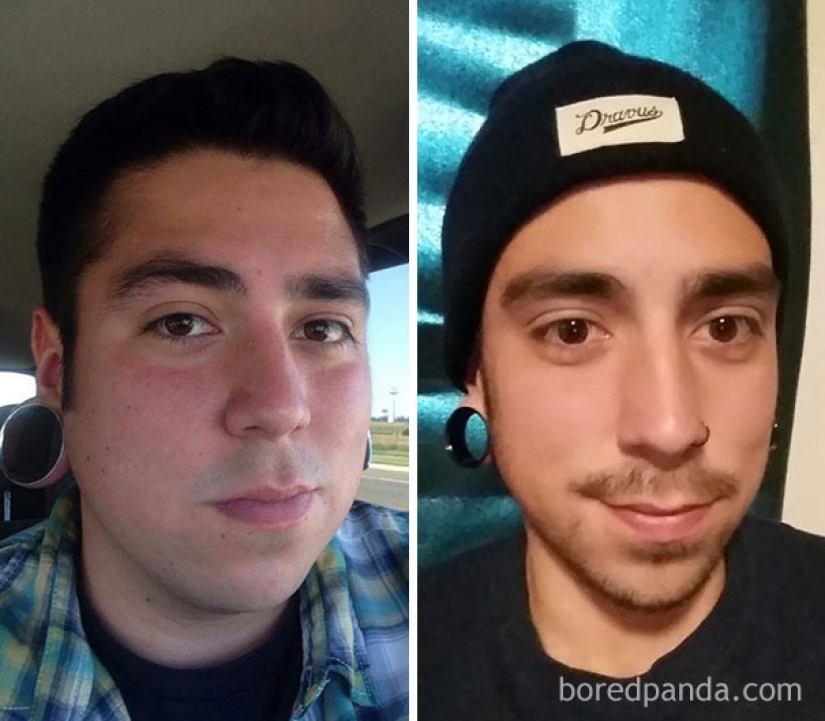 Antes y después: cómo cambia la apariencia de una persona que deja de beber Antes y después: cómo cambia la apariencia de una persona que deja de beber