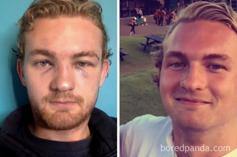 Antes y después: cómo cambia la apariencia de una persona que deja de beber Antes y después: cómo cambia la apariencia de una persona que deja de beber