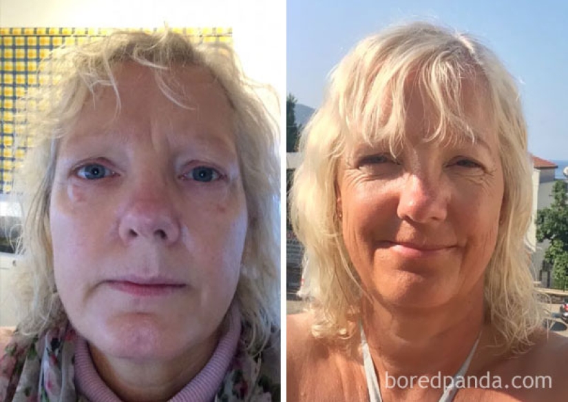 Antes y después: cómo cambia la apariencia de una persona que deja de beber Antes y después: cómo cambia la apariencia de una persona que deja de beber