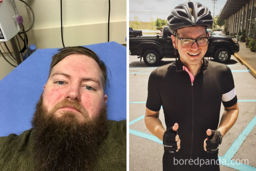 Antes y después: cómo cambia la apariencia de una persona que deja de beber Antes y después: cómo cambia la apariencia de una persona que deja de beber