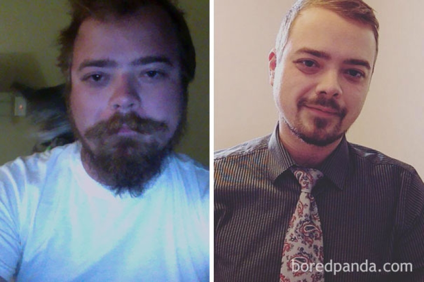 Antes y después: cómo cambia la apariencia de una persona que deja de beber Antes y después: cómo cambia la apariencia de una persona que deja de beber