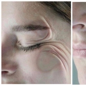 Bayu bayushki, no loisa en el lado! Expertos dijeron acerca de los peligros de dormir boca abajo en la almohada