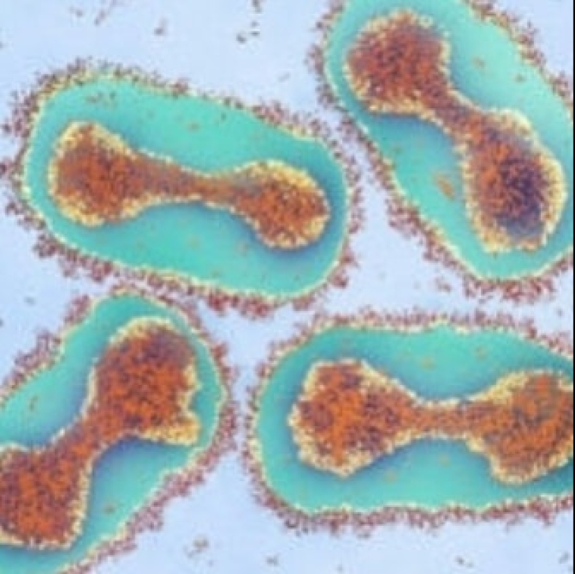 Beauty inside: a microbiologist from Ufa shows on Instagram the viruses and bacteria that live in us Beauty inside: a microbiologist from Ufa shows on Instagram the viruses and bacteria that live in us