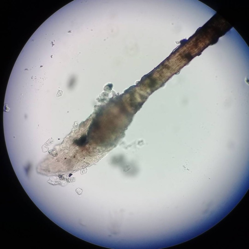 Beauty inside: a microbiologist from Ufa shows on Instagram the viruses and bacteria that live in us Beauty inside: a microbiologist from Ufa shows on Instagram the viruses and bacteria that live in us