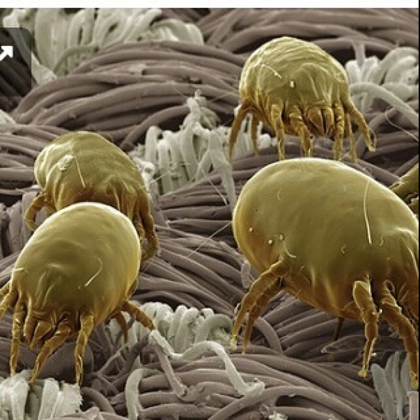 Beauty inside: a microbiologist from Ufa shows on Instagram the viruses and bacteria that live in us Beauty inside: a microbiologist from Ufa shows on Instagram the viruses and bacteria that live in us