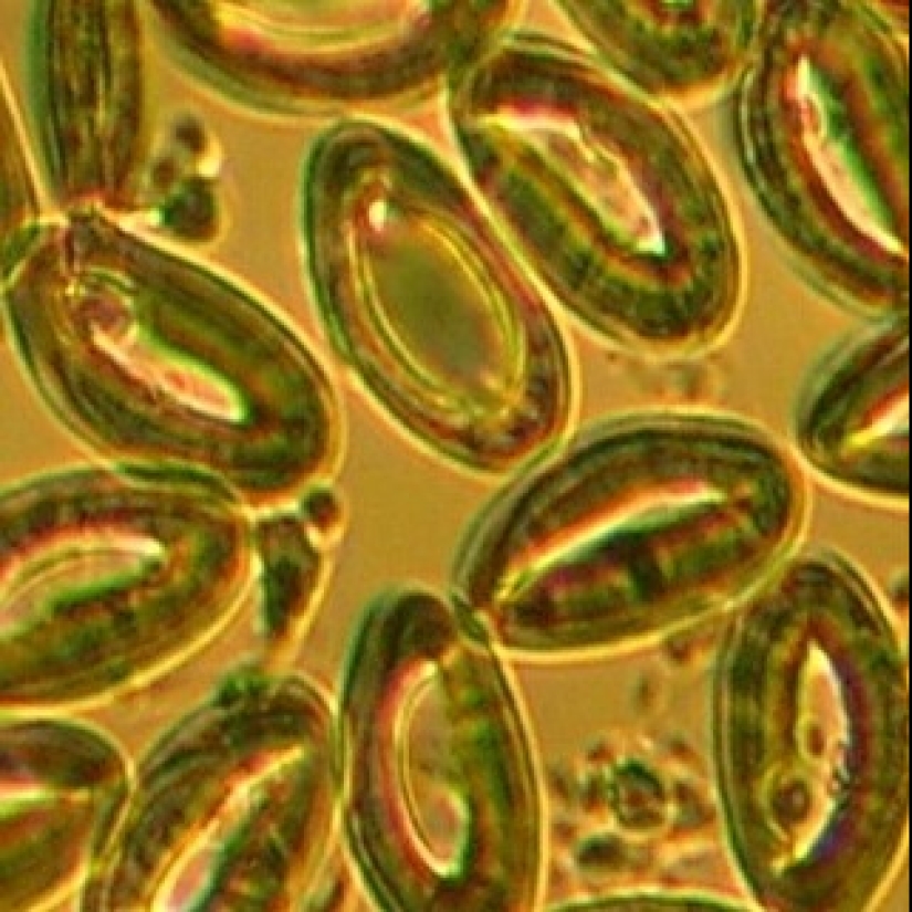 Beauty inside: a microbiologist from Ufa shows on Instagram the viruses and bacteria that live in us Beauty inside: a microbiologist from Ufa shows on Instagram the viruses and bacteria that live in us