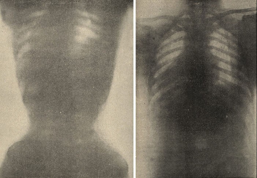 Beauty requires sacrifice and here are 30 vintage photos that prove it Beauty requires sacrifice and here are 30 vintage photos that prove it