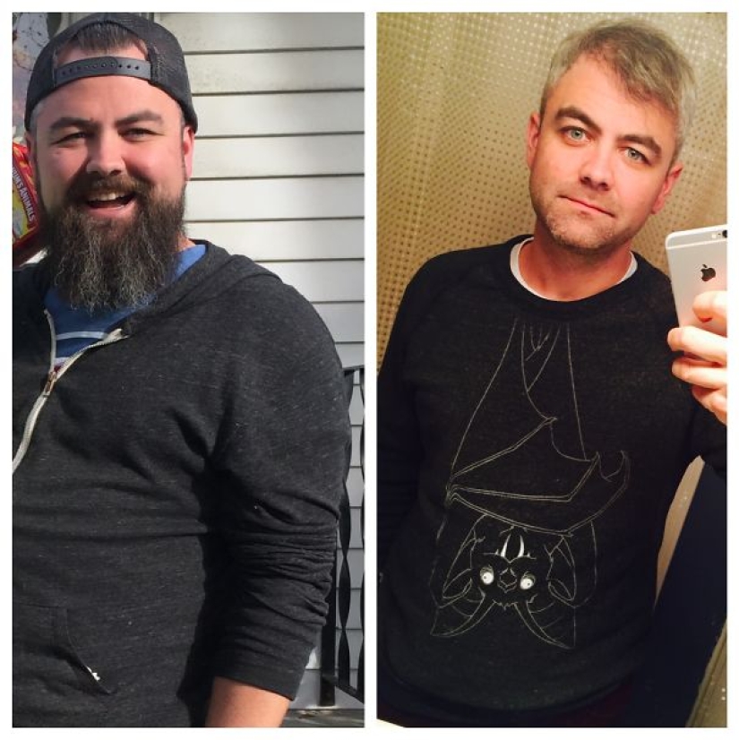 Before and after: how does the appearance of a person who stops drinking change Before and after: how does the appearance of a person who stops drinking change
