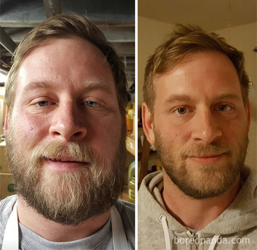 Before and after: how does the appearance of a person who stops drinking change Before and after: how does the appearance of a person who stops drinking change