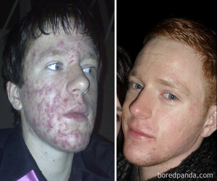 Before and after: how to transform a former "ugly ducklings"