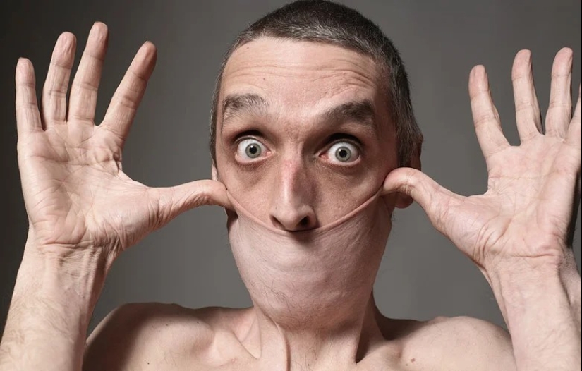 Cara de goma: cómo vive Harry Turner, el hombre con la piel más elástica del mundo Cara de goma: cómo vive Harry Turner, el hombre con la piel más elástica del mundo
