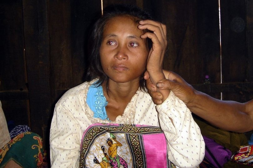 Encontrado en la selva: La triste historia de una mujer camboyana Mowgli Encontrado en la selva: La triste historia de una mujer camboyana Mowgli