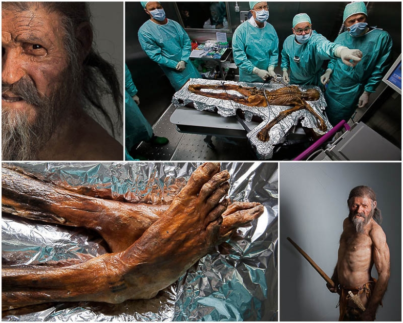 Etzi's "Ice Man" and his story