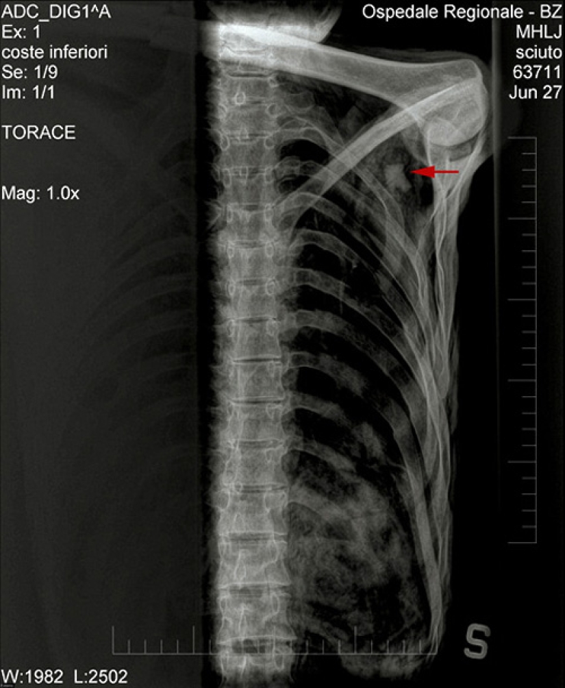 Etzi's "Ice Man" and his story