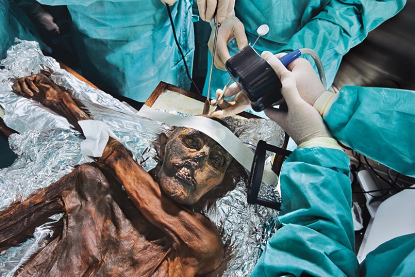 Etzi's "Ice Man" and his story