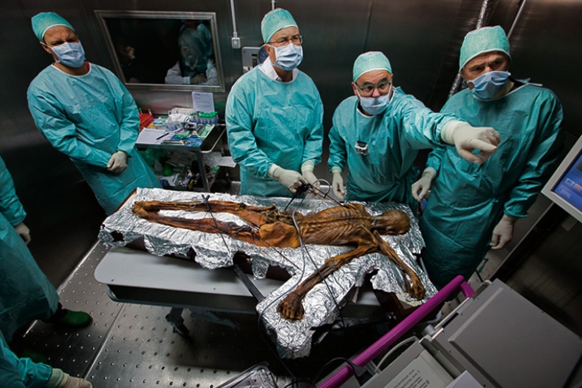 Etzi's "Ice Man" and his story