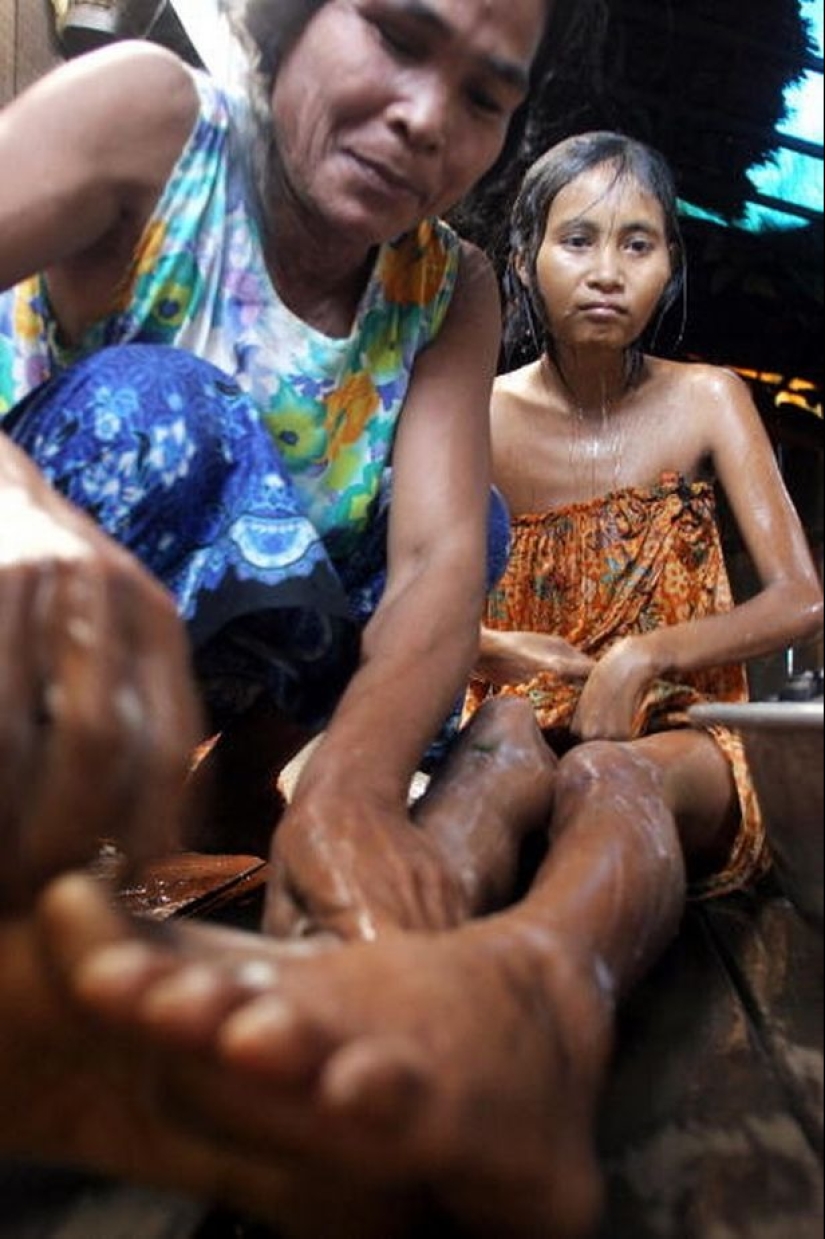 Found in the Jungle: The sad story of a Cambodian Mowgli woman Found in the Jungle: The sad story of a Cambodian Mowgli woman