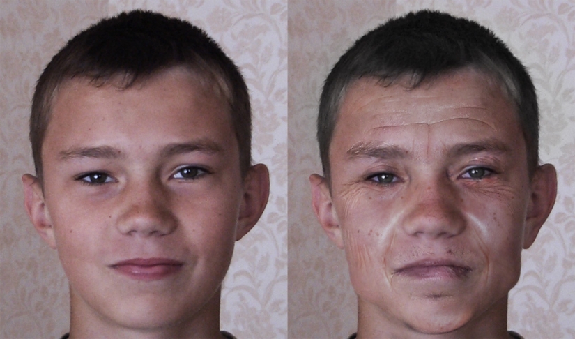Gastronomy tan, or How to recognize an alcoholic in appearance Gastronomy tan, or How to recognize an alcoholic in appearance