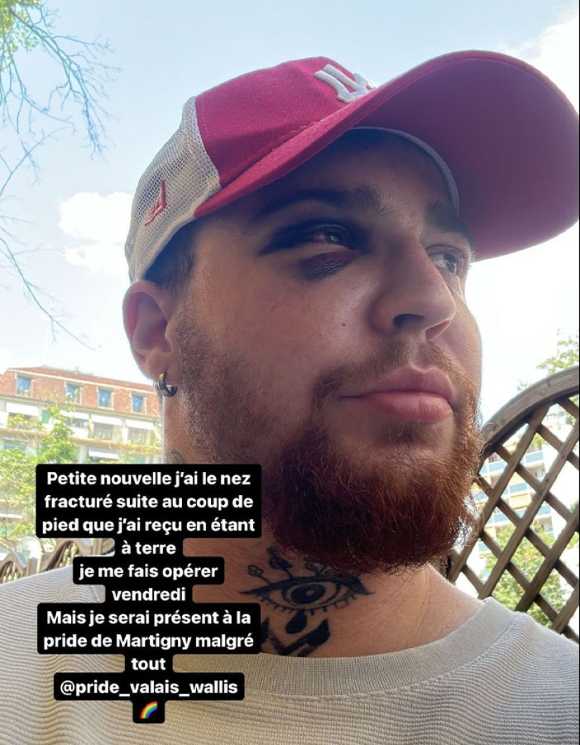 Hombre trans de 29 años es brutalmente golpeado en Suiza y afirma que es un crimen de odio Hombre trans de 29 años es brutalmente golpeado en Suiza y afirma que es un crimen de odio