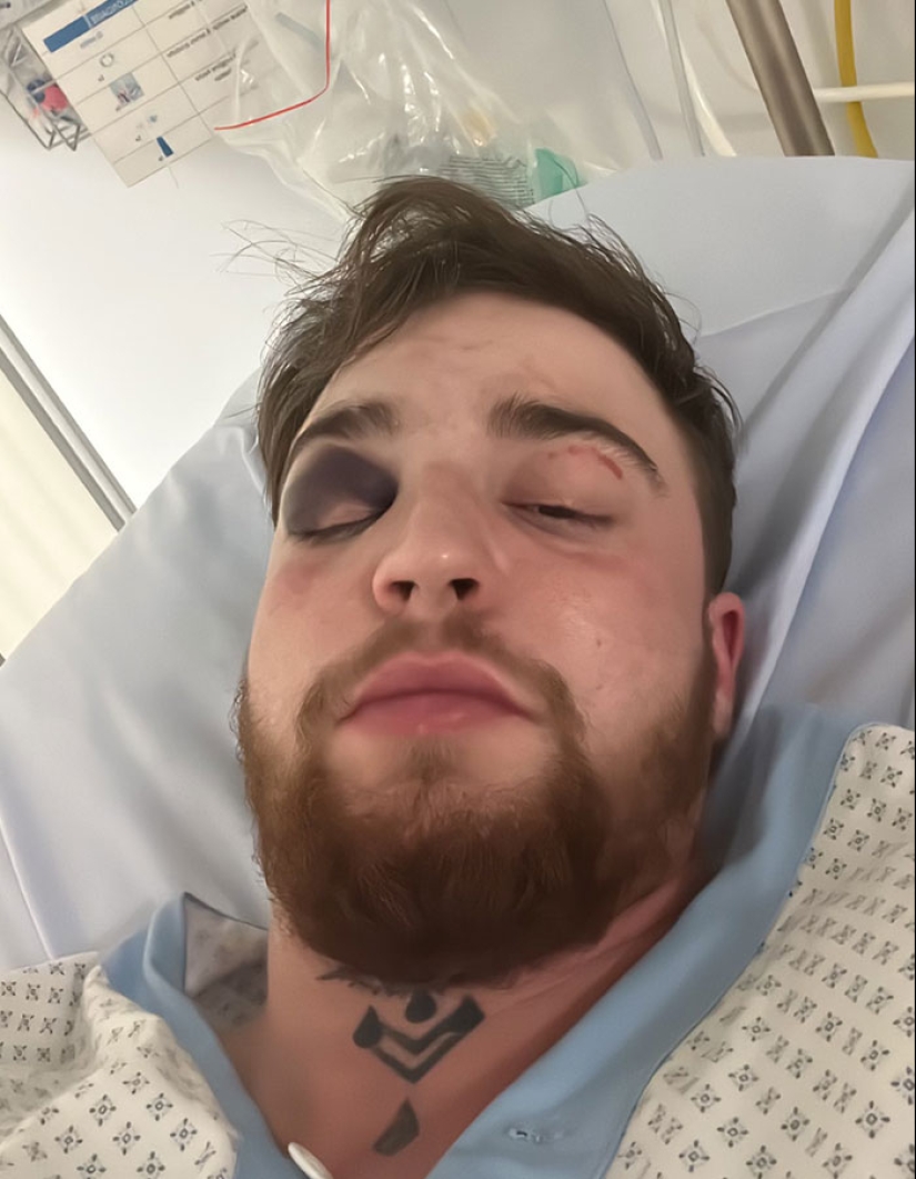 Hombre trans de 29 años es brutalmente golpeado en Suiza y afirma que es un crimen de odio Hombre trans de 29 años es brutalmente golpeado en Suiza y afirma que es un crimen de odio