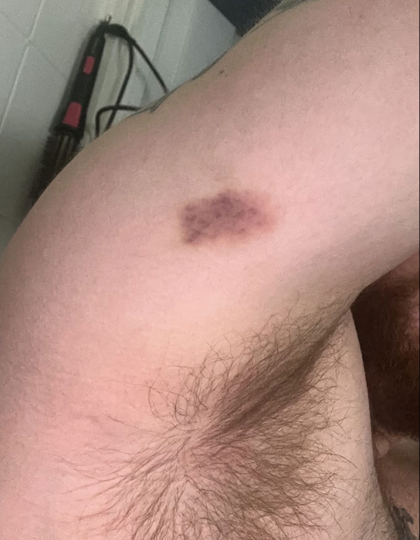 Hombre trans de 29 años es brutalmente golpeado en Suiza y afirma que es un crimen de odio Hombre trans de 29 años es brutalmente golpeado en Suiza y afirma que es un crimen de odio