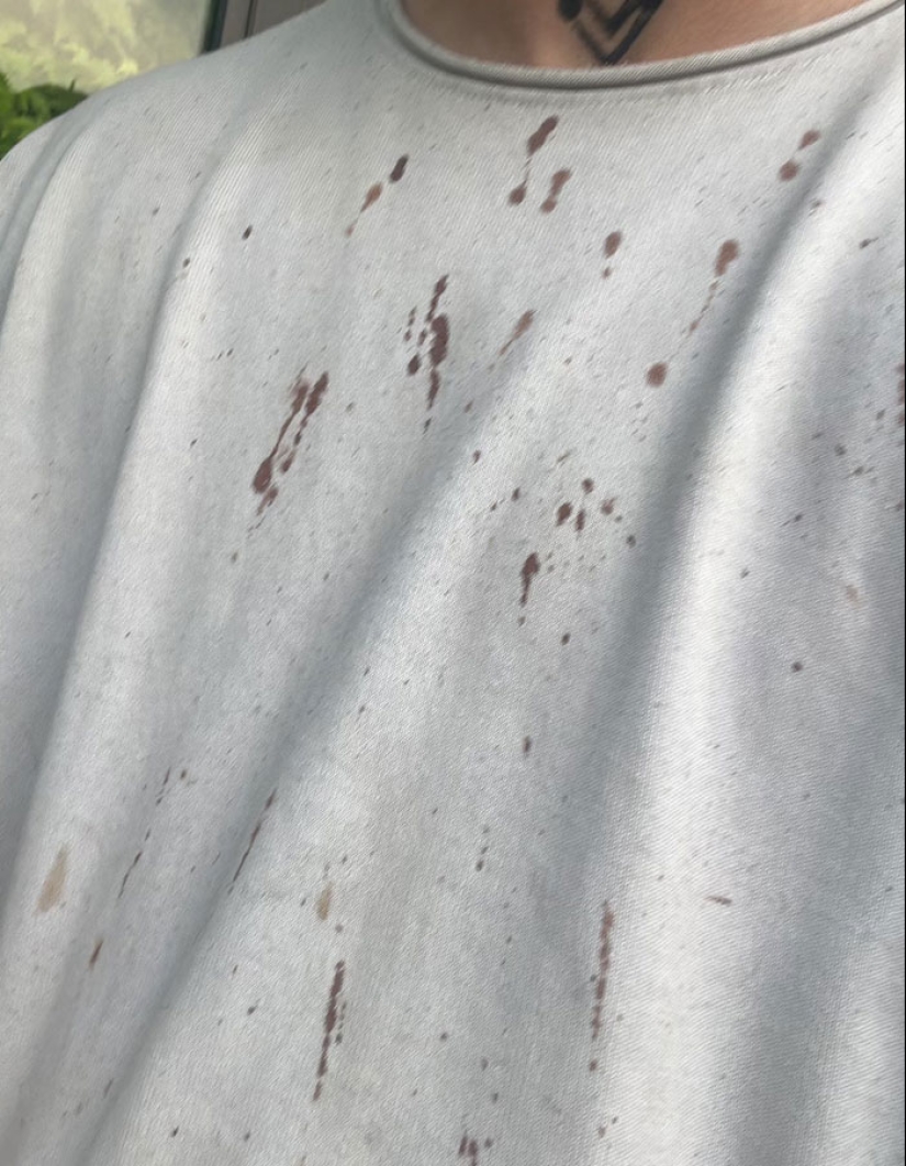 Hombre trans de 29 años es brutalmente golpeado en Suiza y afirma que es un crimen de odio Hombre trans de 29 años es brutalmente golpeado en Suiza y afirma que es un crimen de odio