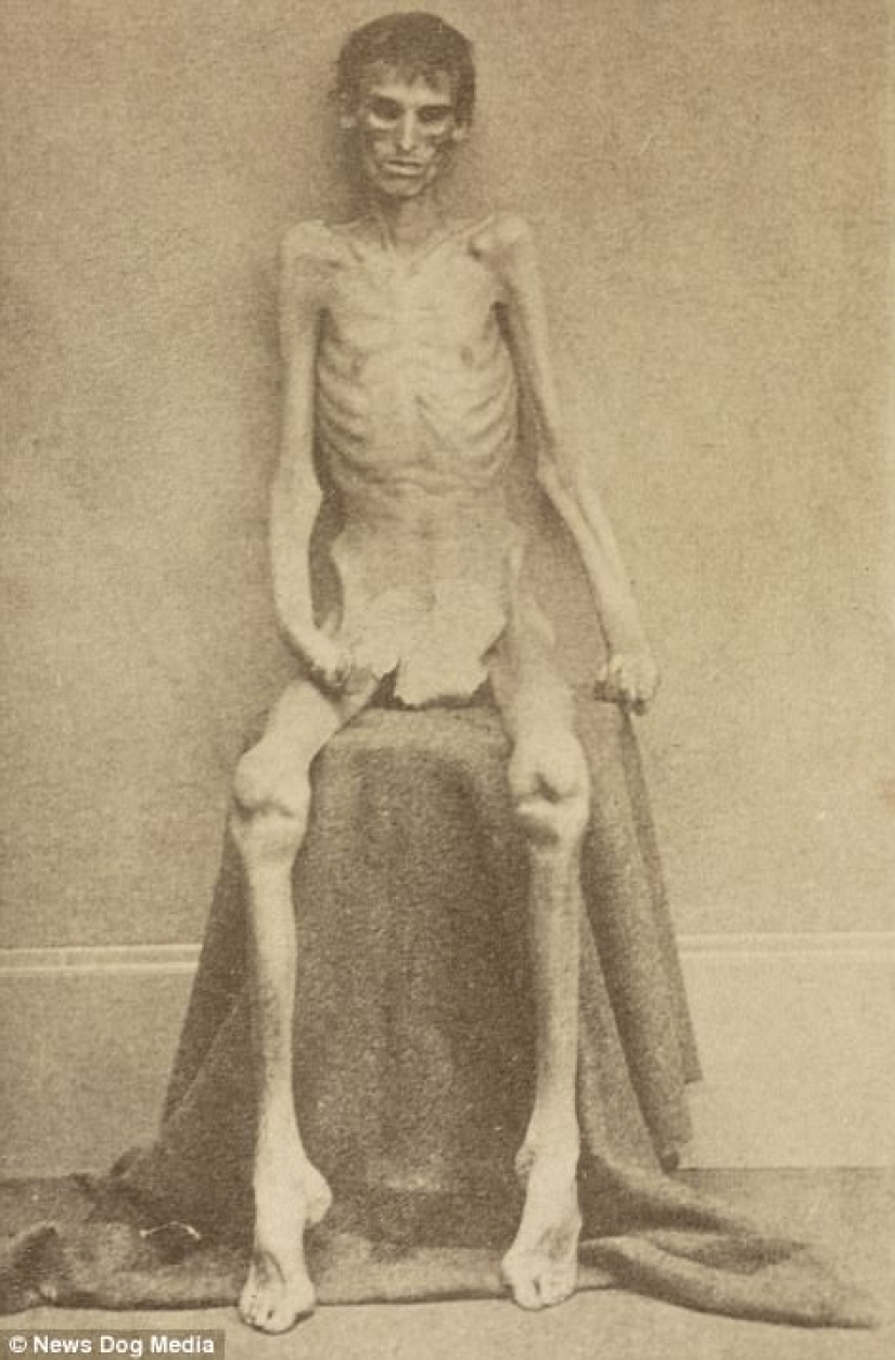 Horribles fotos de víctimas de la guerra más sangrienta de la historia de Estados Unidos Horribles fotos de víctimas de la guerra más sangrienta de la historia de Estados Unidos
