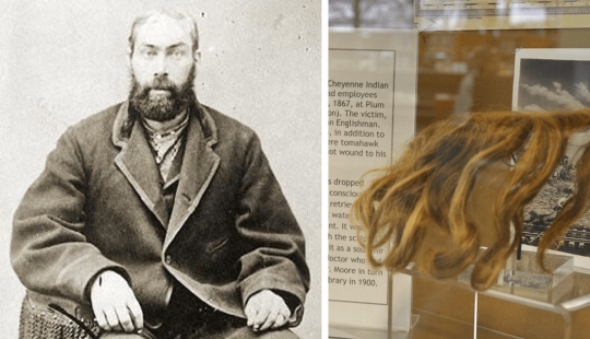 How the Indians scalped an Englishman, and he survived and gave the scalp to the museum: the story of William Thompson How the Indians scalped an Englishman, and he survived and gave the scalp to the museum: the story of William Thompson