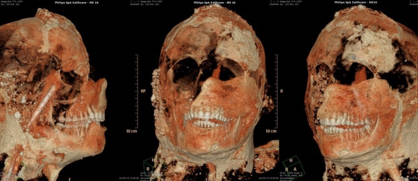 How the inhabitants of Pompeii died How the inhabitants of Pompeii died