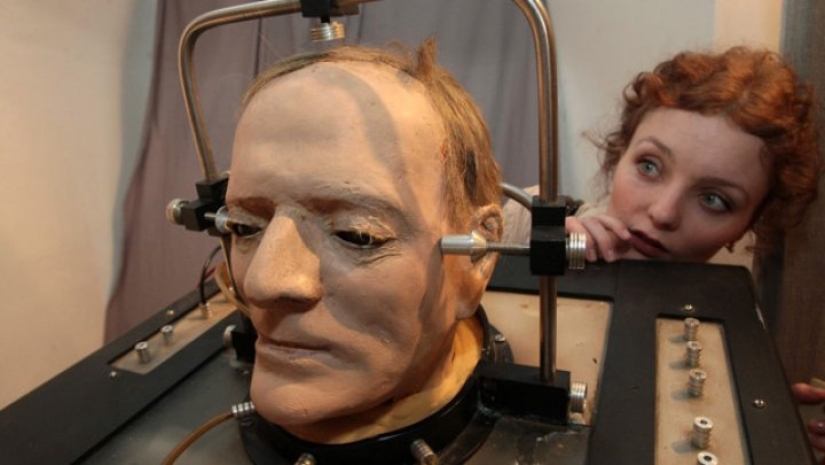 Is it possible to transplant a human head