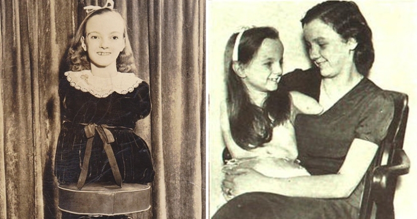 La conmovedora historia de Frida la media niña, una de las últimas estrellas de la era de los “circos freaks” La conmovedora historia de Frida la media niña, una de las últimas estrellas de la era de los “circos freaks”